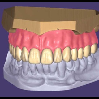 Avatar of Telegram channel "exocad-3shape-cerec expert" @dentalsoft3d